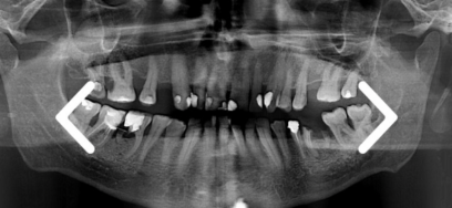 Senior w gabinecie dentystycznym – na co zwrócić uwagę, przyjmując starszego pacjenta